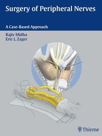 Produktbild: Surgery of Peripheral Nerves