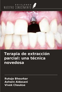 Produktbild: Terapia de extracci&oacute;n parcial: una t&eacute;cnica novedosa
