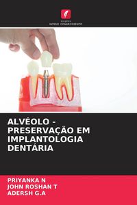 Produktbild: Alv&eacute;olo - Preserva&ccedil;&atilde;o Em Implantologia Dent&aacute;ria