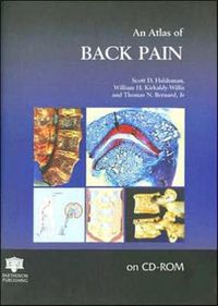 Bild vom Artikel Haldeman, S: An Atlas of Back Pain vom Autor Scott D. Haldeman