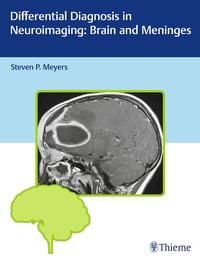 Produktbild: Differential Diagnosis in Neuroimaging: Brain and Meninges