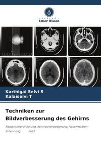 Produktbild: Techniken zur Bildverbesserung des Gehirns