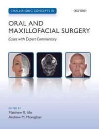 Produktbild: Challenging Concepts in Oral and Maxillofacial Surgery