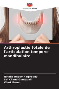 Produktbild: Arthroplastie totale de l'articulation temporo-mandibulaire