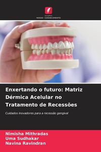 Produktbild: Enxertando o futuro: Matriz D&eacute;rmica Acelular no Tratamento de Recess&otilde;es