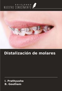 Produktbild: Distalizaci&oacute;n de molares