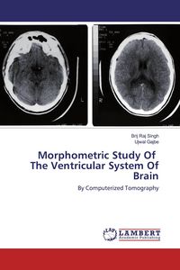 Produktbild: Morphometric Study Of The Ventricular System Of Brain