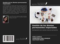 Produktbild: Gesti&oacute;n de los dientes permanentes impactados
