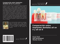 Produktbild: Comparaci&oacute;n entre implantes dentales all on 4 y all on 6