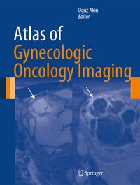 Produktbild: Atlas of Gynecologic Oncology Imaging
