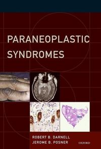 Produktbild: Paraneoplastic Syndromes