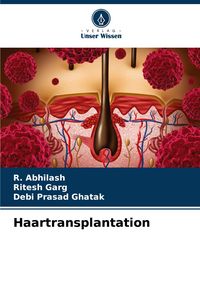 Produktbild: Haartransplantation