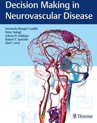 Produktbild: Decision Making in Neurovascular Disease
