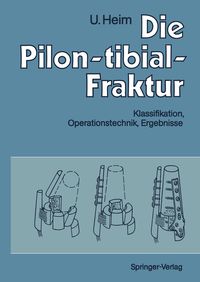 Produktbild: Die Pilon-tibial-Fraktur