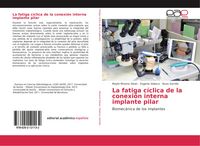 Produktbild: La fatiga c&iacute;clica de la conexi&oacute;n interna implante pilar