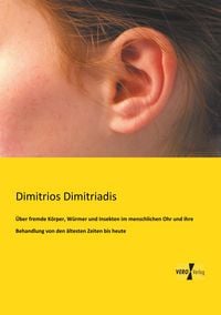 Produktbild: &Uuml;ber fremde K&ouml;rper, W&uuml;rmer und Insekten im menschlichen Ohr und ihre Behandlung von den &auml;ltesten Zeiten bis heute
