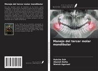 Produktbild: Manejo del tercer molar mandibular