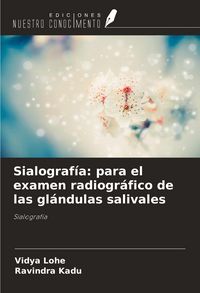 Produktbild: Sialograf&iacute;a: para el examen radiogr&aacute;fico de las gl&aacute;ndulas salivales