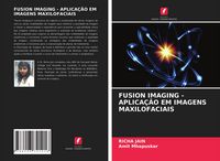 Produktbild: Fusion Imaging - Aplica&ccedil;&atilde;o Em Imagens Maxilofaciais