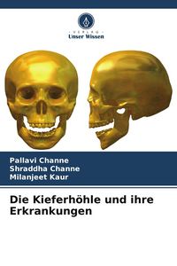 Produktbild: Die Kieferh&ouml;hle und ihre Erkrankungen