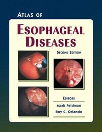 Produktbild: Atlas of Esophageal Diseases