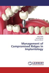 Produktbild: Management of Compromised Ridges In Implantology