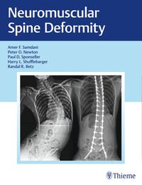 Produktbild: Neuromuscular Spine Deformity