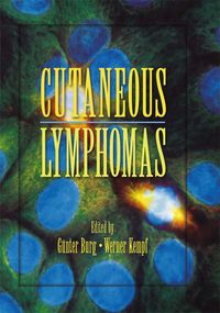 Produktbild: Cutaneous Lymphomas