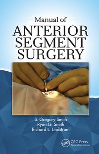 Produktbild: Manual of Anterior Segment Surgery