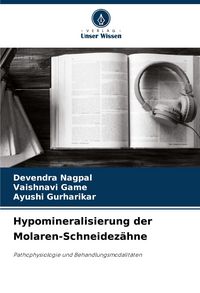 Produktbild: Hypomineralisierung der Molaren-Schneidez&auml;hne