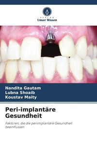 Produktbild: Peri-implant&auml;re Gesundheit