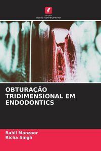 Produktbild: Obtura&ccedil;&atilde;o Tridimensional Em Endodontics