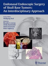 Produktbild: Endonasal Endoscopic Surgery of Skull Base Tumors: An Interdisciplinary Approach