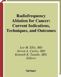 Produktbild: Radiofrequency Ablation for Cancer