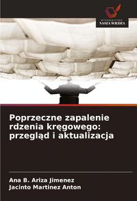 Produktbild: Poprzeczne zapalenie rdzenia kr&iquest;gowego: przegl&iquest;d i aktualizacja