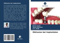Produktbild: Okklusion bei Implantaten