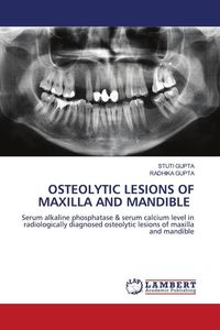 Produktbild: OSTEOLYTIC LESIONS OF MAXILLA AND MANDIBLE