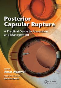 Produktbild: Posterior Capsular Rupture