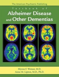 Produktbild: The American Psychiatric Publishing Textbook of Alzheimer Disease and Other Dementias