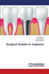 Produktbild: Surgical Guides in Implants