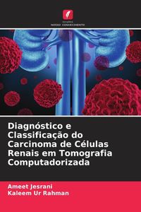 Produktbild: Diagn&oacute;stico e Classifica&ccedil;&atilde;o do Carcinoma de C&eacute;lulas Renais em Tomografia Computadorizada