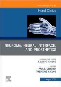 Produktbild: Neuroma, Neural Interface, and Prosthetics, an Issue of Hand Clinics