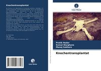 Produktbild: Knochentransplantat