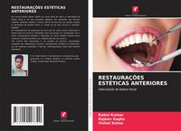 Produktbild: Restaura&ccedil;&otilde;es Est&eacute;ticas Anteriores