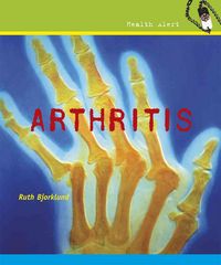 Produktbild: Arthritis