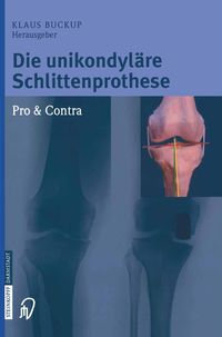 Produktbild: Die unikondyl&auml;re Schlittenprothese Pro & Contra