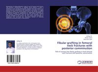 Produktbild: Fibular grafting in femoral neck fractures with posterior comminution