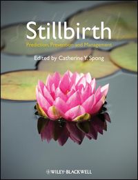 Produktbild: Stillbirth