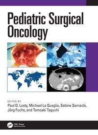 Produktbild: Pediatric Surgical Oncology