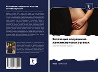 Produktbild: Kalechaschie operacii na zhenskih polowyh organah: